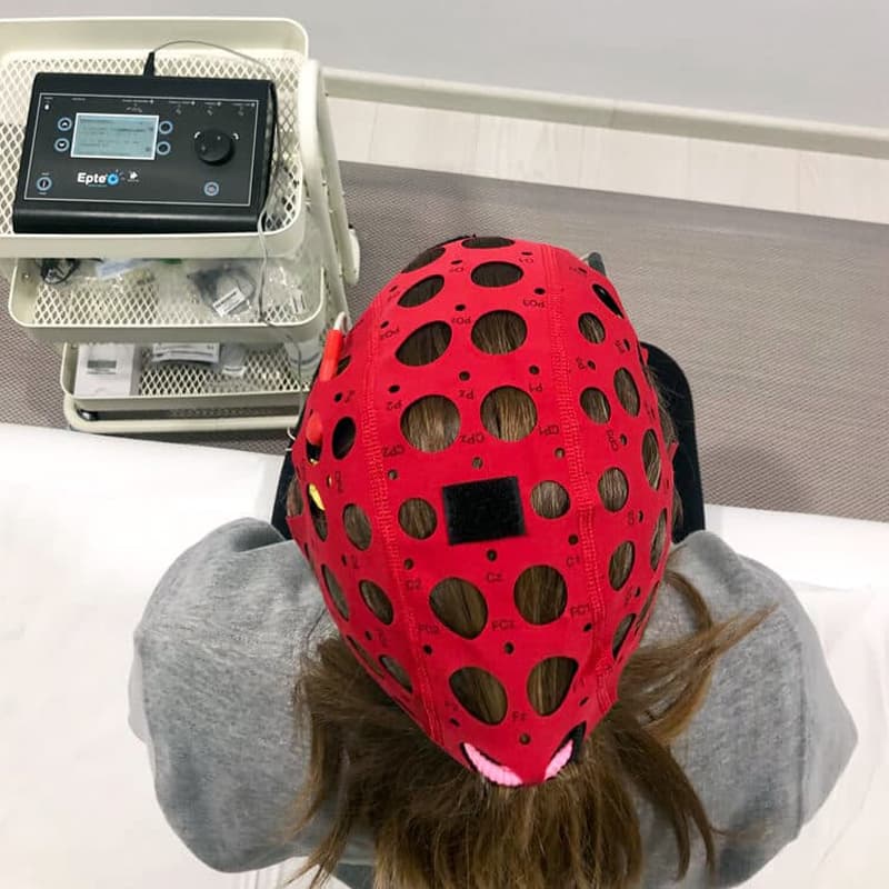 Estimulación transcraneal por corriente directa (TDCS)